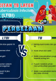 Perbezaan LTBI VS TB